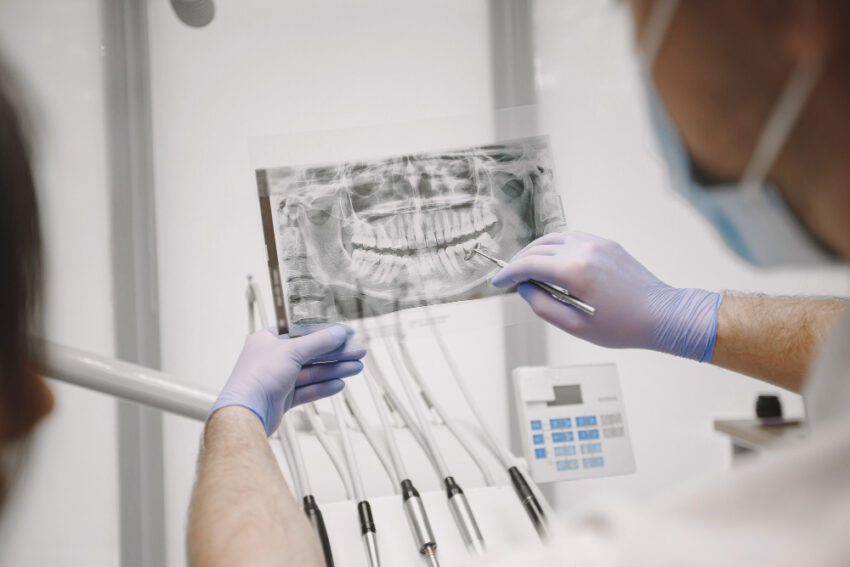 De ce să pui un aparat dentar: motive și beneficii
